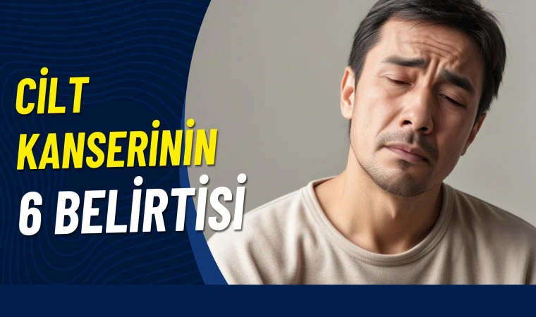 Cilt kanserinin 6 belirtisine dikkat!