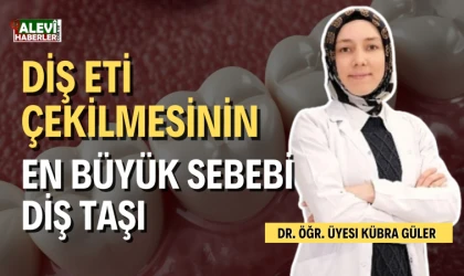 Diş eti çekilmesinin en büyük sebebi diş taşı!